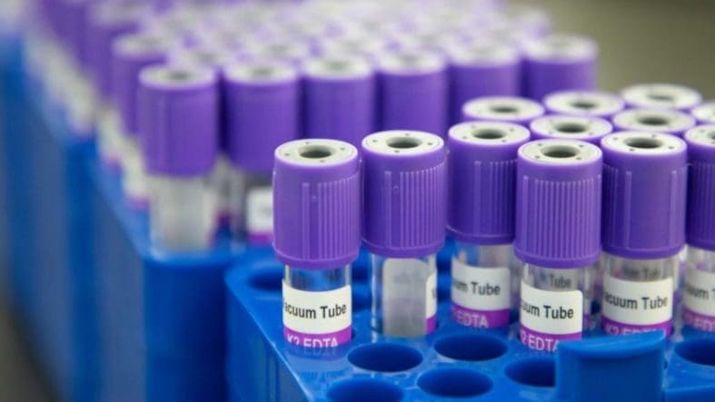 Kanseri tespit edebilen kan testi yüzde 99 doğruluk oranına ulaştı