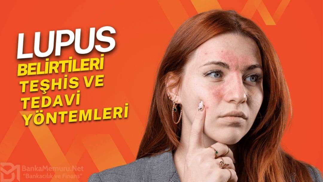 lupus-kelebek-hastaligi-nedir